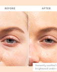 Skin Remedy Soothing Eye Gels